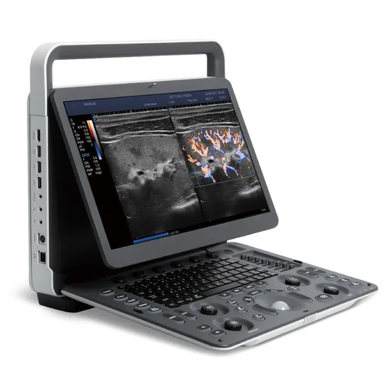 Sistema portátil do ultrassom de Doppler da cor da máquina do ultrassom de Sonoscape E3