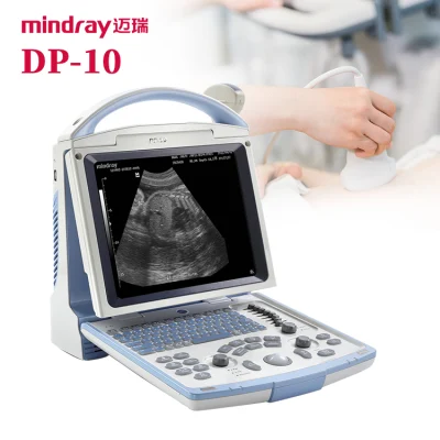 Sistema ultrassônico portátil do ecógrafo da máquina do ultrassom de Mindray Dp10