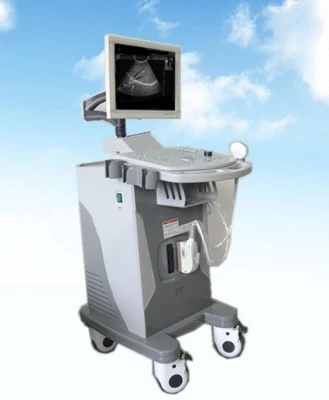 Ce/ISO aprovou ultrassom de diagnóstico de 15 polegadas com sonda de 96 elementos e carrinho (YJ