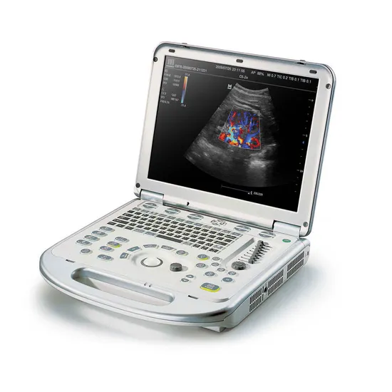 Sistema de ultrassom Doppler colorido com sistema de diagnóstico por imagem ultrassônico portátil Mindray M7 Premium