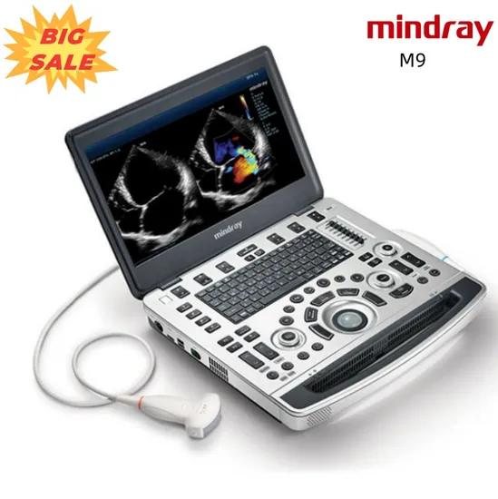 Preço de ultrassom Doppler portátil Sistema de diagnóstico de ultrassom Doppler colorido